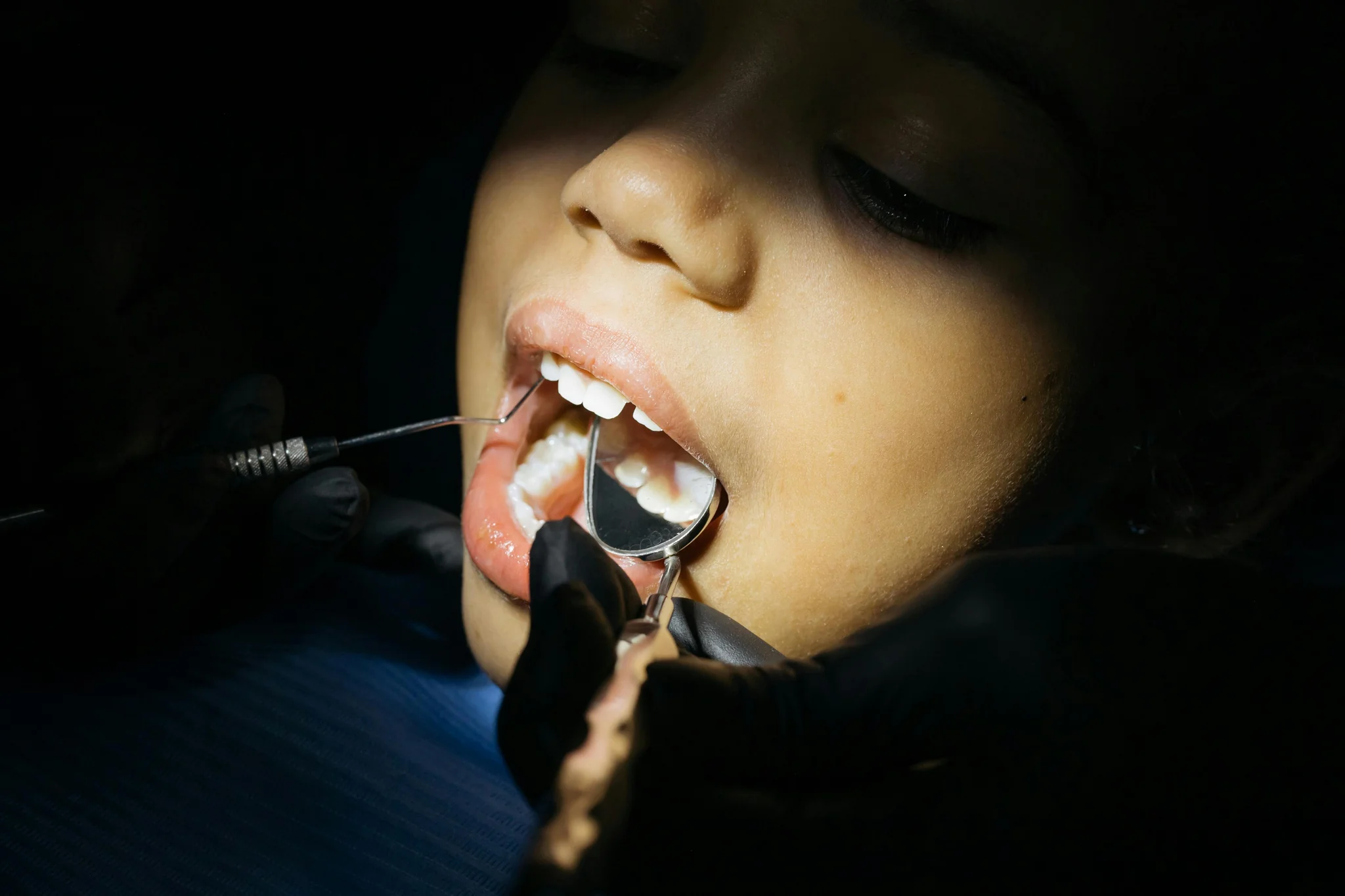 Dental treatment procedure